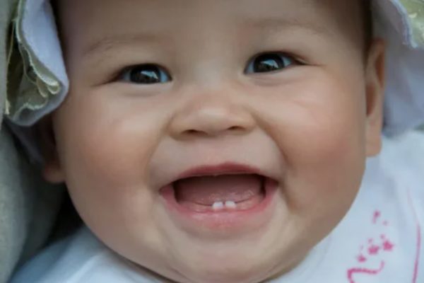 Trẻ mọc răng chậm nên bổ sung những gì?