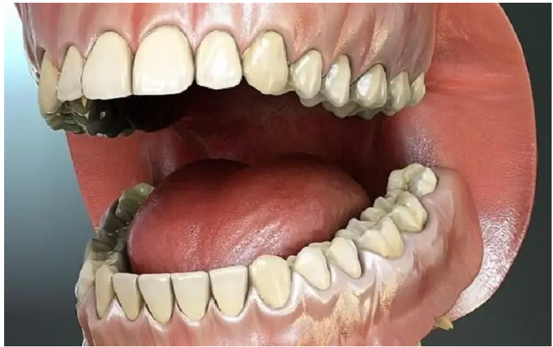 Cấu trúc răng khôn hàm dưới