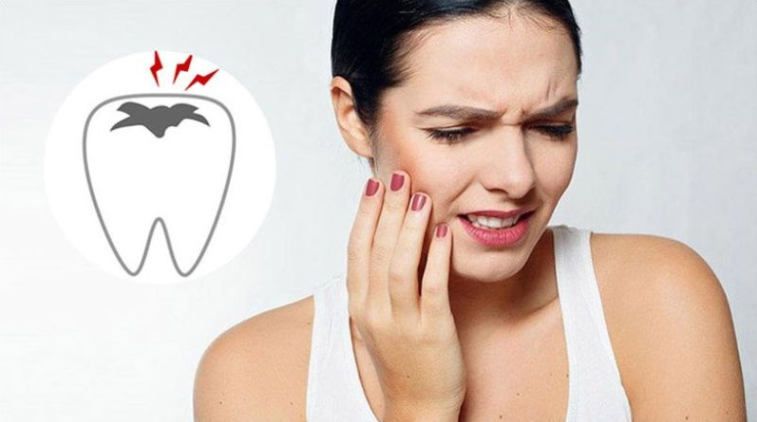 Sưng đau sau khi nhổ 4 răng khôn