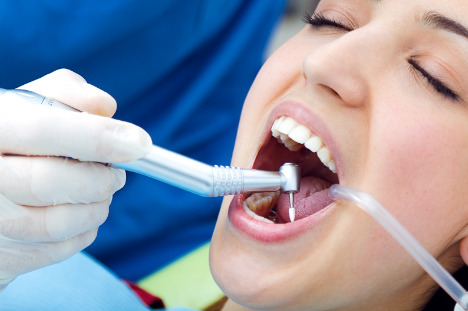Điều trị viêm lợi sau khi bọc răng sứ