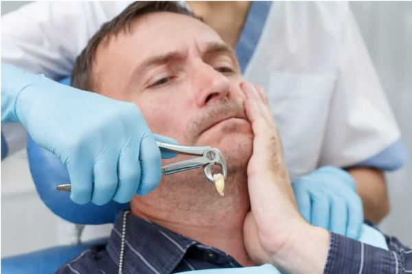 Tất cả lưu ý bạn cần biết trước – sau nhổ răng khôn. Tất cả lưu ý bạn cần biết trước – sau nhổ răng khôn.