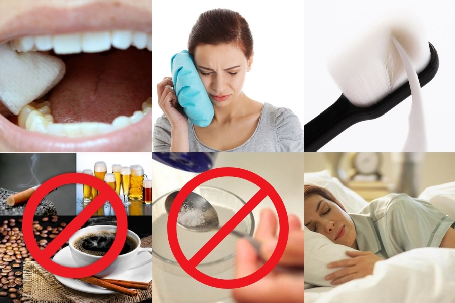 Hướng dẫn chăm sóc sau nhổ răng
